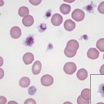 Normal feline erythrocyte with platelets (inset)