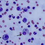 Figure 2: Peritoneal fluid from a dog