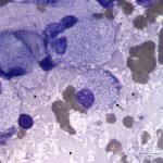 Figure 3a: Jejunal lymph node aspirate from a cat (Wright's stain, 100x).