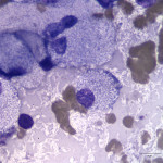Figure 3: Jejunal lymph node aspirate from a cat (Wright's stain, 100x). 