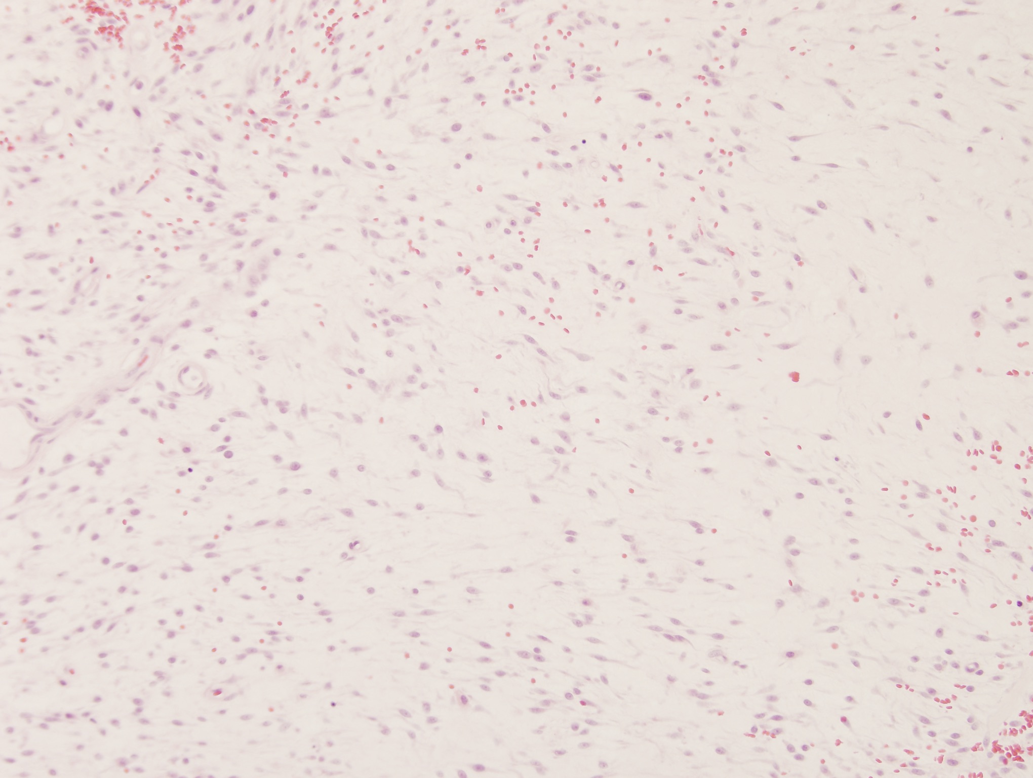 Figure 9: Histologic section of a mass on the paw of a cat. | eClinpath