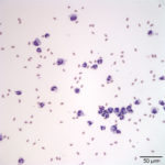 Figure1a. Peritoneal fluid from an alpaca (Wright's stain, 20x objective)