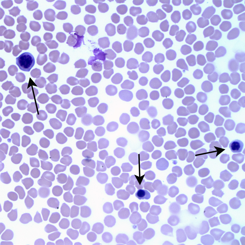 Fig 1a: Blood smear from a dog (Wright's stain, 500X) | eClinpath