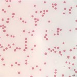 Figure 1b: High power blood smear from steer (Wright's stain, 500x)