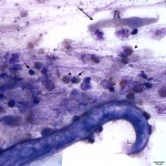 Figure 2. Tracheal wash sediment smear (Wright's stain, 50x)