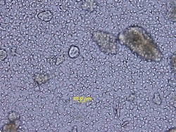 Figure 2: Zinc Sulfate Fecal Flotation | eClinpath