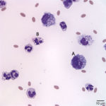 Fig2. Peritoneal fluid from an alpaca (Wright's stain, 50x objective)