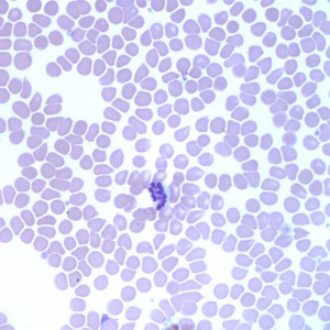 Fig 2: Blood from a dog (Wright's stain, 500X)