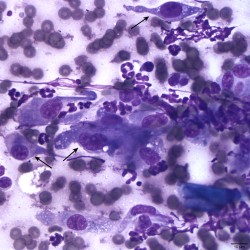 Figure 3: Skin mass from a dog (Diff-Quik stain, 50x) | eClinpath