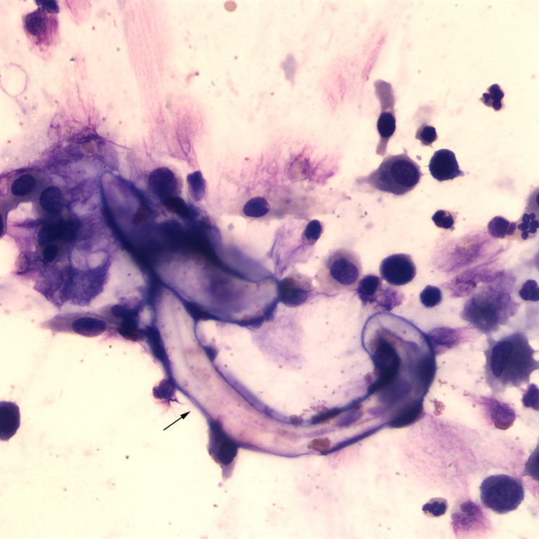 Figure 4: Sediment Of A Tracheal Wash From Goat #2 | EClinpath