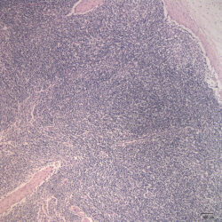 Figure 4: Histologic section of lymph node from a cow with Theileria ...