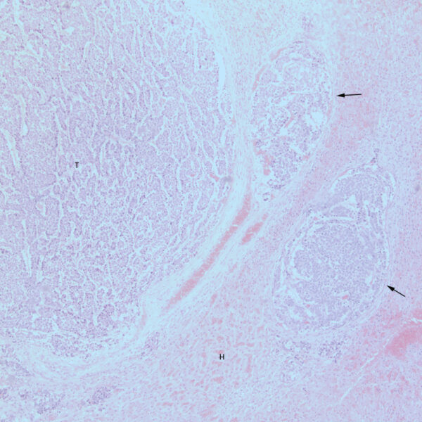 Fig6_Nov2017
