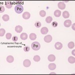 Figure 1: Blood smear (labeled)