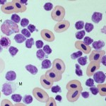 Figure 1a: Avian leukocytes (labelled)
