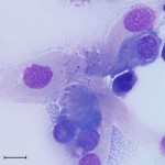 Figure 2: High magnification of tracheal wash sediment