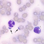 Figure 2b: Jejunal lymph node aspirate of Wallaby (labelled) (Wright's stain, 1000x)