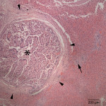 Figure 5. Liver, Rabbit, HE stain. Markedly ectatic and hyperplastic bile duct compresses adjacent hepatic parenchyma. Note the size of ectatic bile duct (asterisk) when compared to non-affected bile duct (arrow). Moderate perioportal fibrosis (arrowheads) and mild inflammatory infiltrates are also seen. 