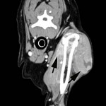 Figure 6: CT scan