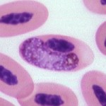 Hemoproteus in avian blood