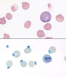 HB hemolytic anemia cat