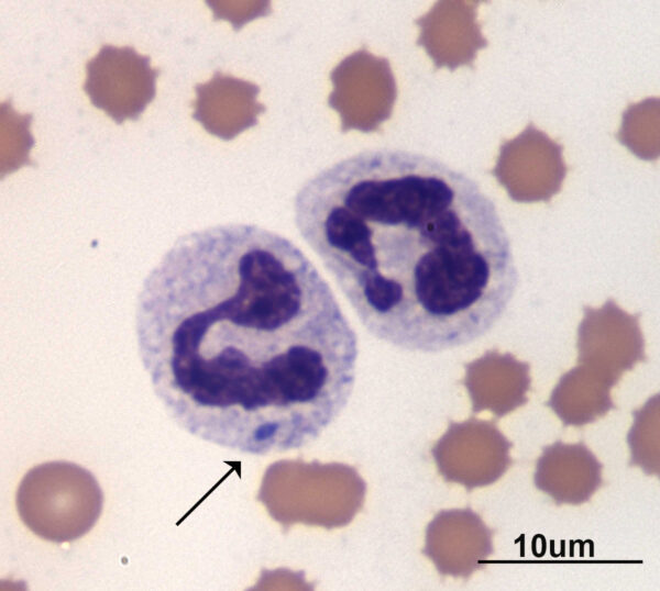 Fig 1A June 2015