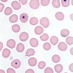 Howell-Jolly bodies from a splenectomized dog