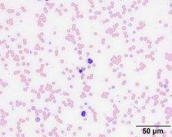 Figure 1: Venous blood smear from an anemic cat | eClinpath