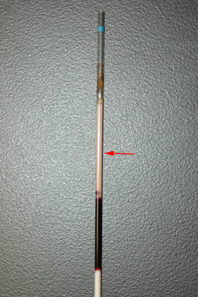 Lipemia