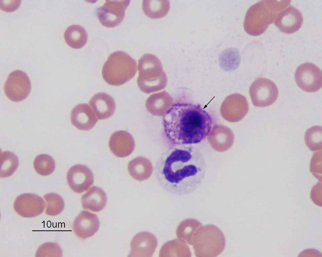 Mast cell in blood