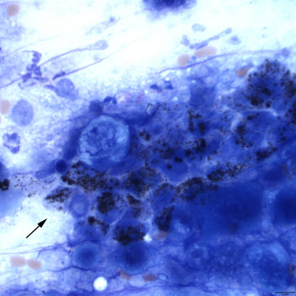 Fig2B_May2017
