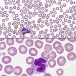 Example of an area of the blood smear where a monolayer is formed.