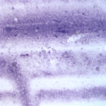 Figure 5. Joint aspirate from a tortoise with pseudogout. Wrights stain, 500x.