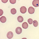 Mycoplasma haemominutum