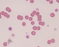 Non-regenerative immune-mediated anemia in a dog | eClinpath