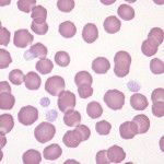 Normal equine erythrocytes and a few platelets.