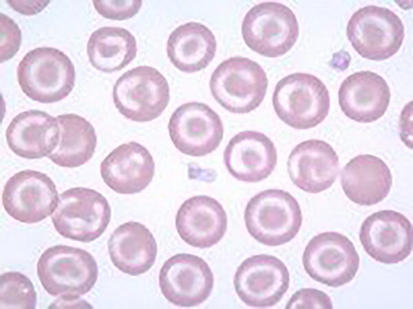 Target cells