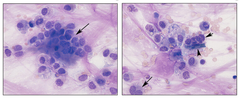 Tracheal Wash Cells | EClinpath