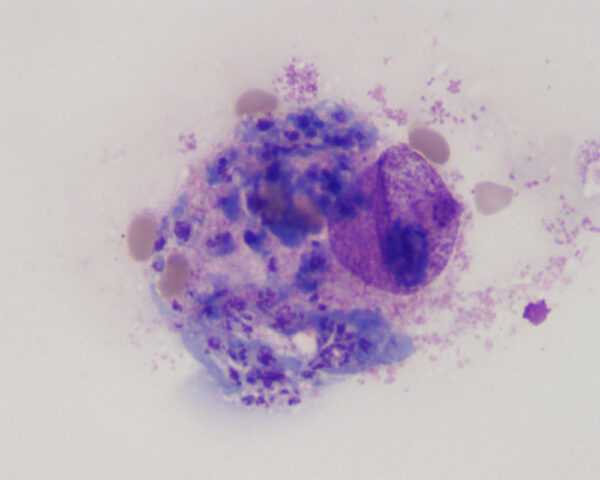 Cytaux schizont