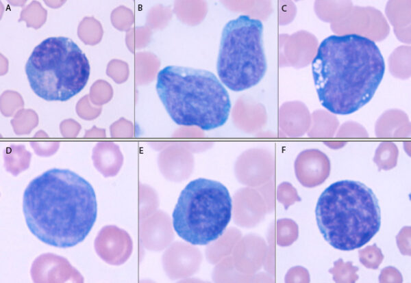 Big blue cells