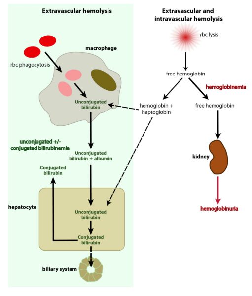 bilirubin hemolysis