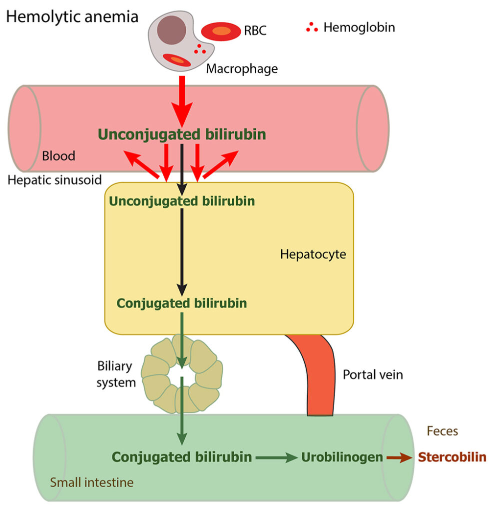 What Does High Bilirubin Mean In A Blood Test at Cathy Brito blog