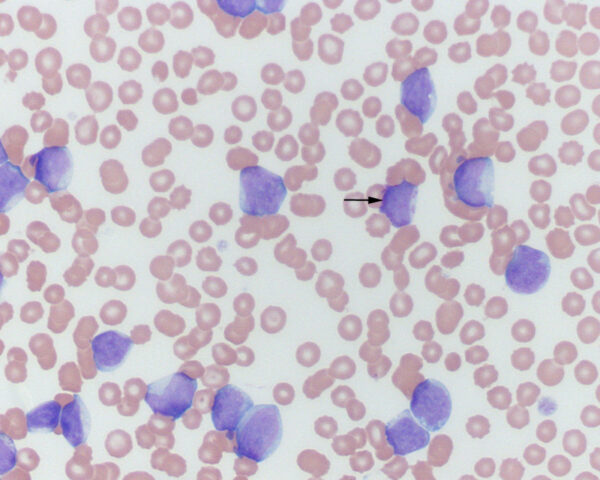 Monoblasts