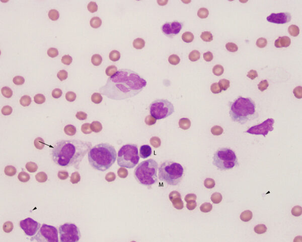 Mononuclear cells