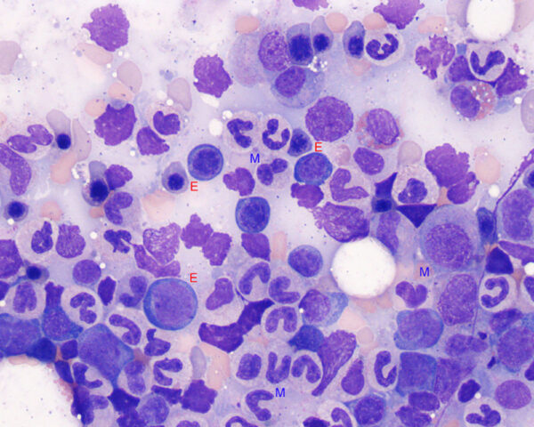 Myeloid to erythroid ratio