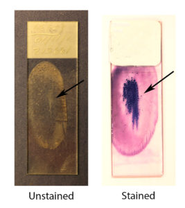 Bone marrow slides