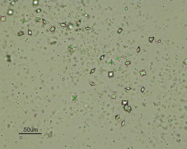 Ca oxalate dihydrate