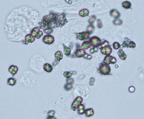 Ammonium biurate