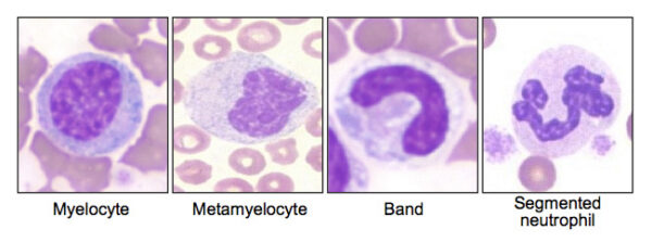 Neutrophil stages