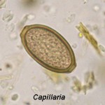 Capillaria egg