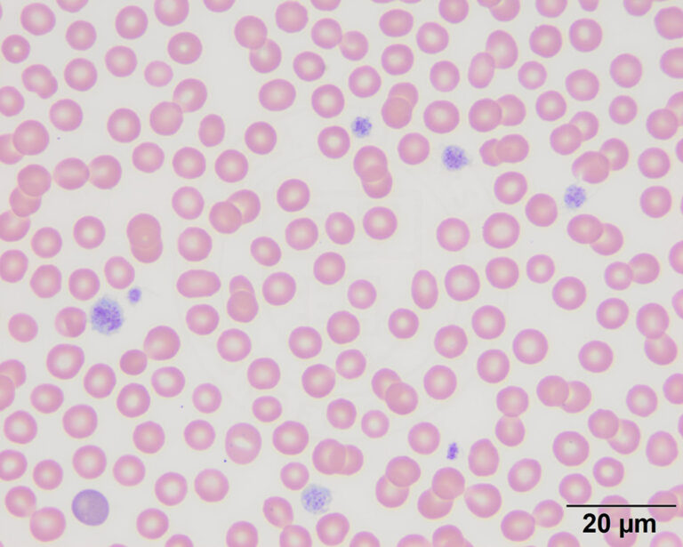 Inherited macrothrombocytopenia in a Cavalier King Charles Spaniel ...